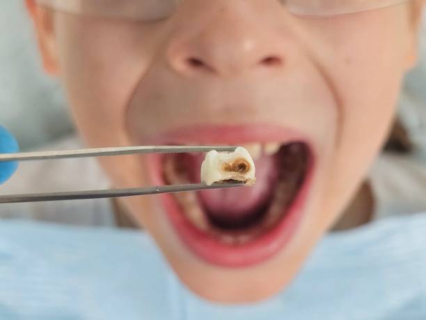 Best Emergency TMJ Treatment in Red Bud, IL
